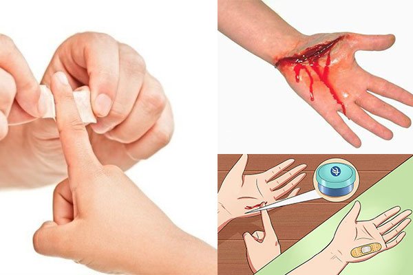 Bản án số: 61/2020/DS-PT Toà án nhân dân Thành phố Hồ Chí Minh về Tranh chấp hợp đồng bảo hiểm.